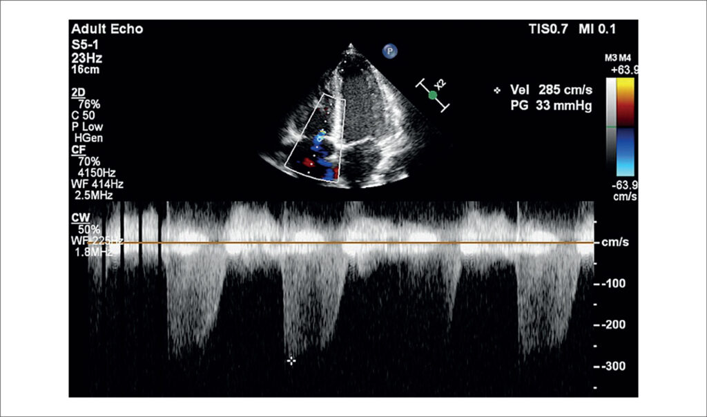 Figure 4