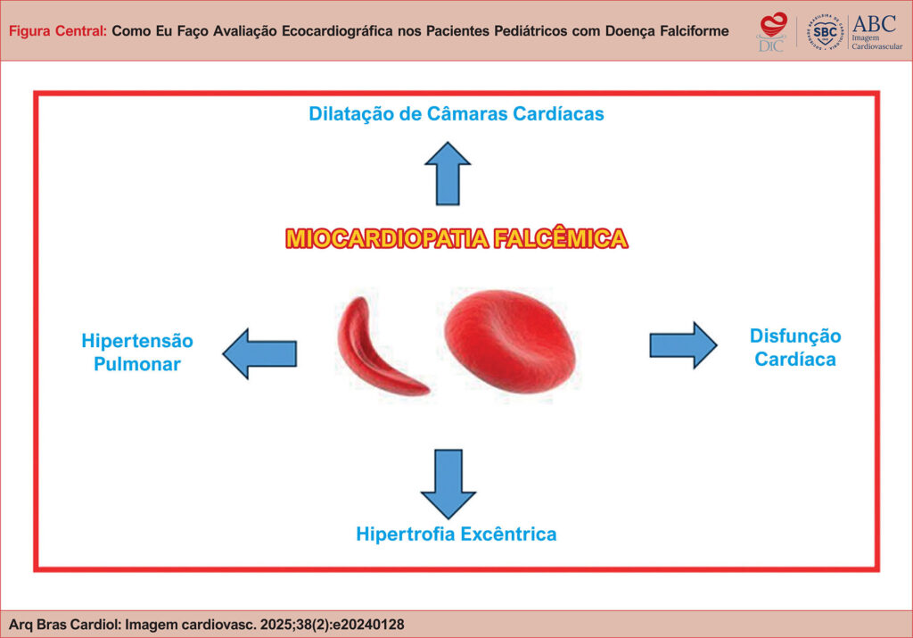 Avaliação ecocardiográfica em paciente com Doença Falciforme.