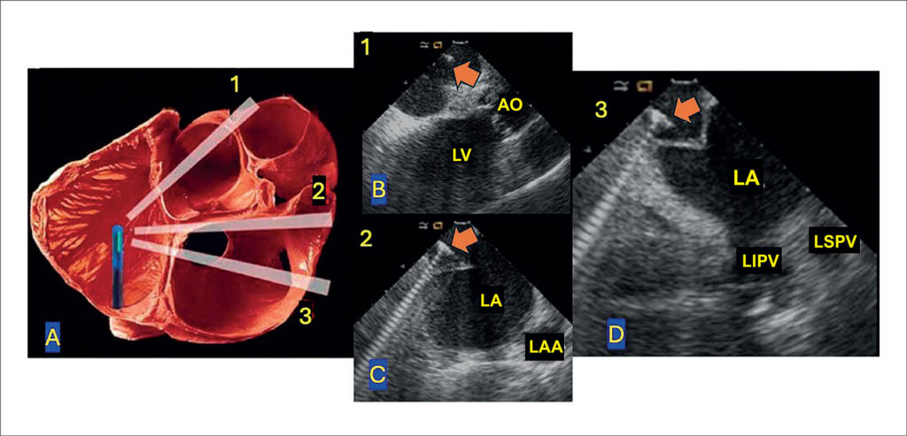 Figure 4