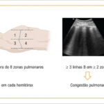 Figura 2