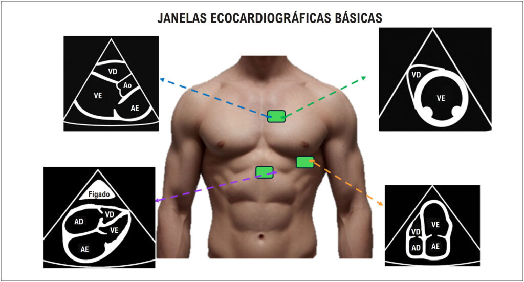 Figura 2