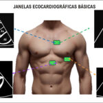 Figura 2