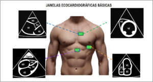 Figura 2