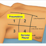 Figura 4
