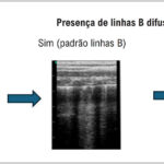 Figura 11