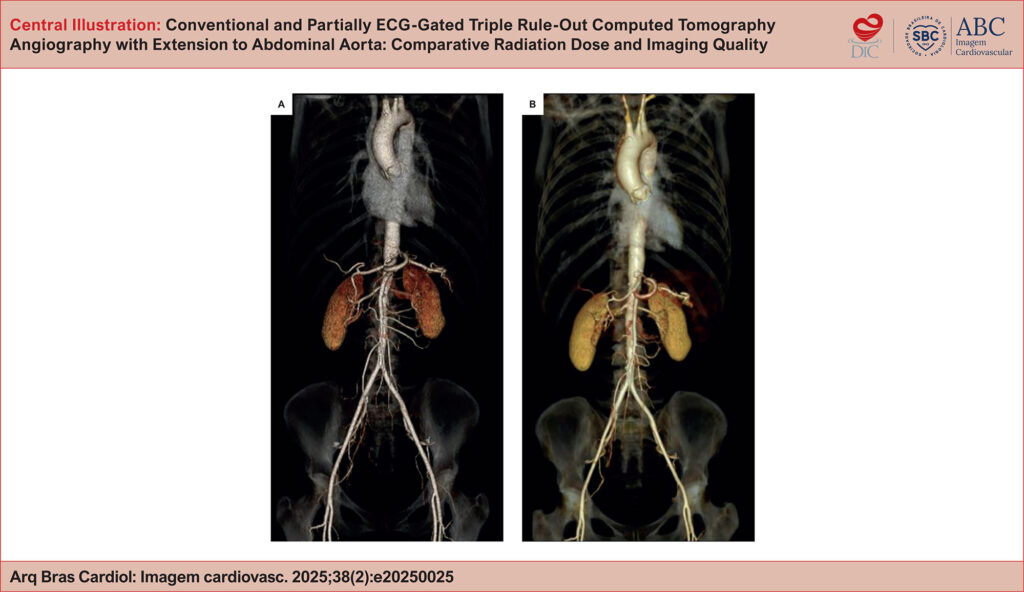 Three-dimensional volume-rendering CTA reconstructions of the same patient showing no significant difference in the overall image quality between fully (A) and partially (B) ECG-gated TRO scans.