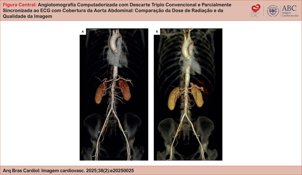 Reconstruções tridimensionais de ATC com renderização de volume do mesmo paciente, mostrando ausência de diferença significativa na qualidade geral da imagem entre os exames com TRO totalmente (A) e parcialmente (B) sincronizados ao ECG.