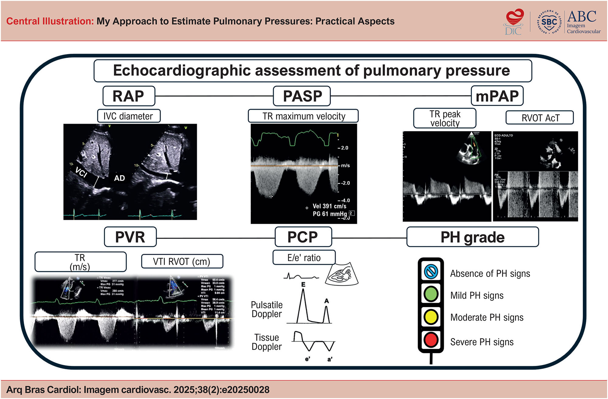My Approach to Estimate Pulmonary Pressures: Practical Aspects