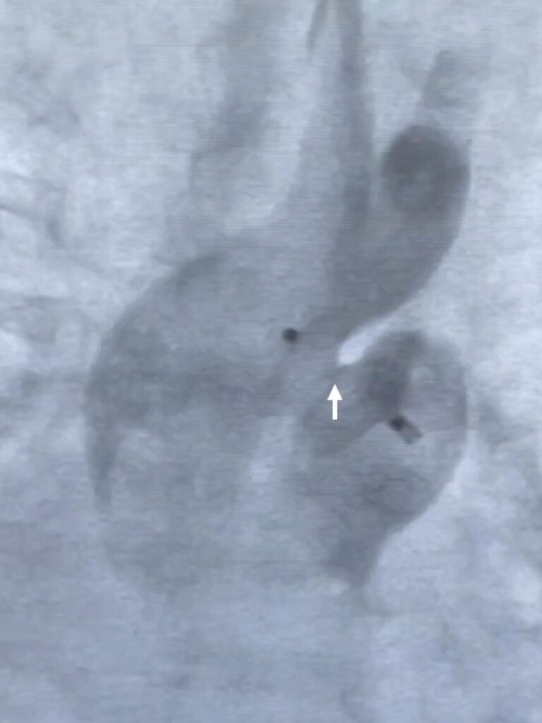 Figura 3