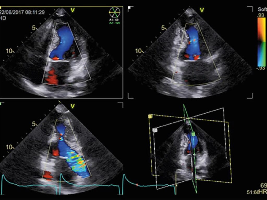 Figure 2