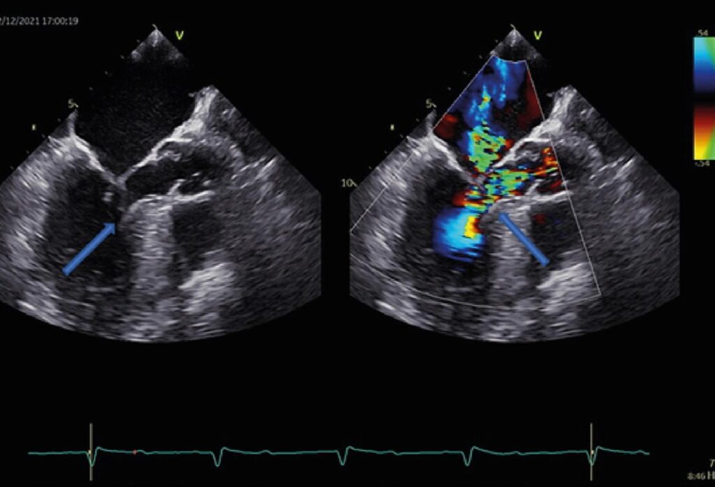 Figure 6