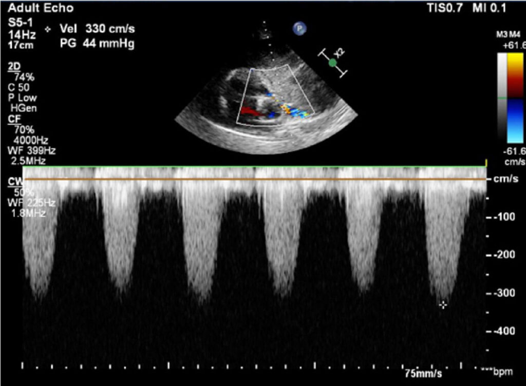 Figure 2