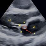 Figura 11