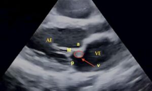 Figura 11
