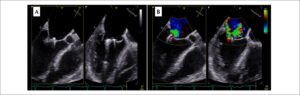Figura 2