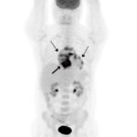 Figura 1