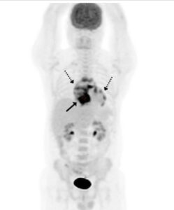 Figura 1