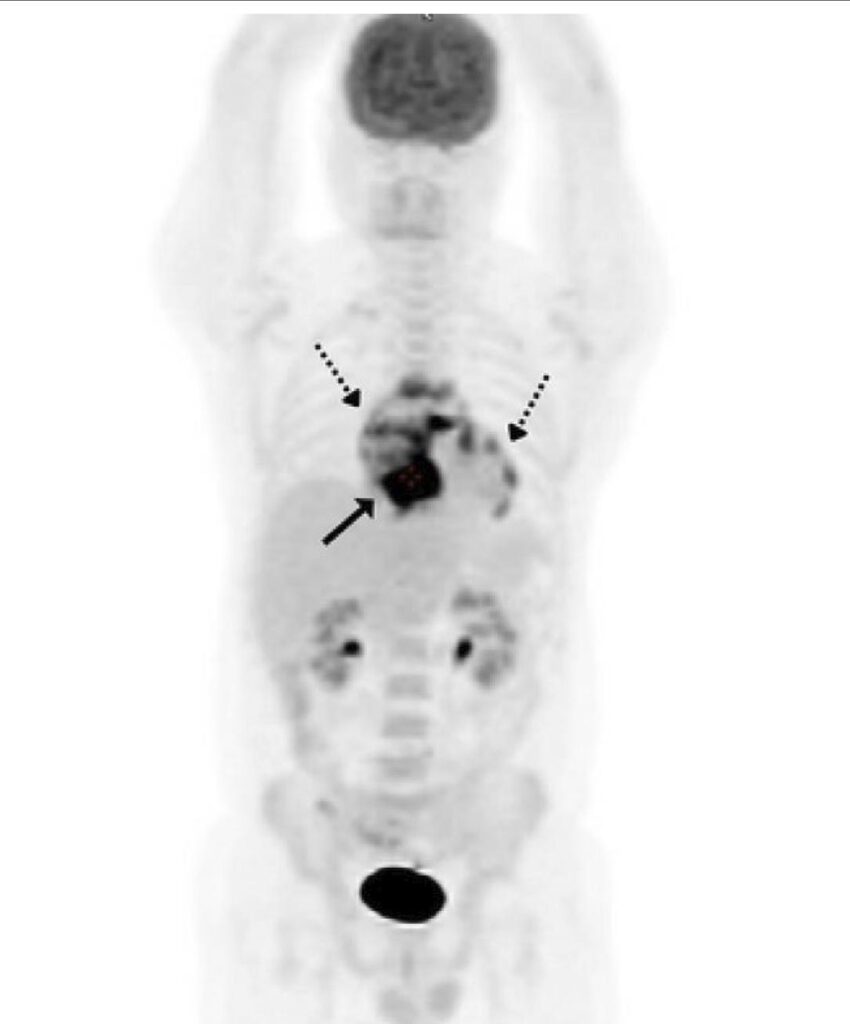 Figura 1