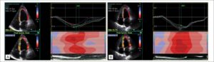 Figura 1