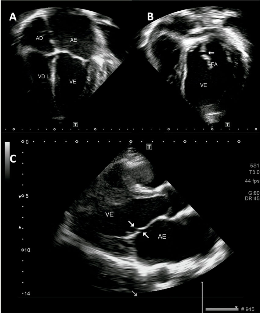 Figura 2