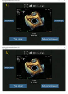 Figura 3