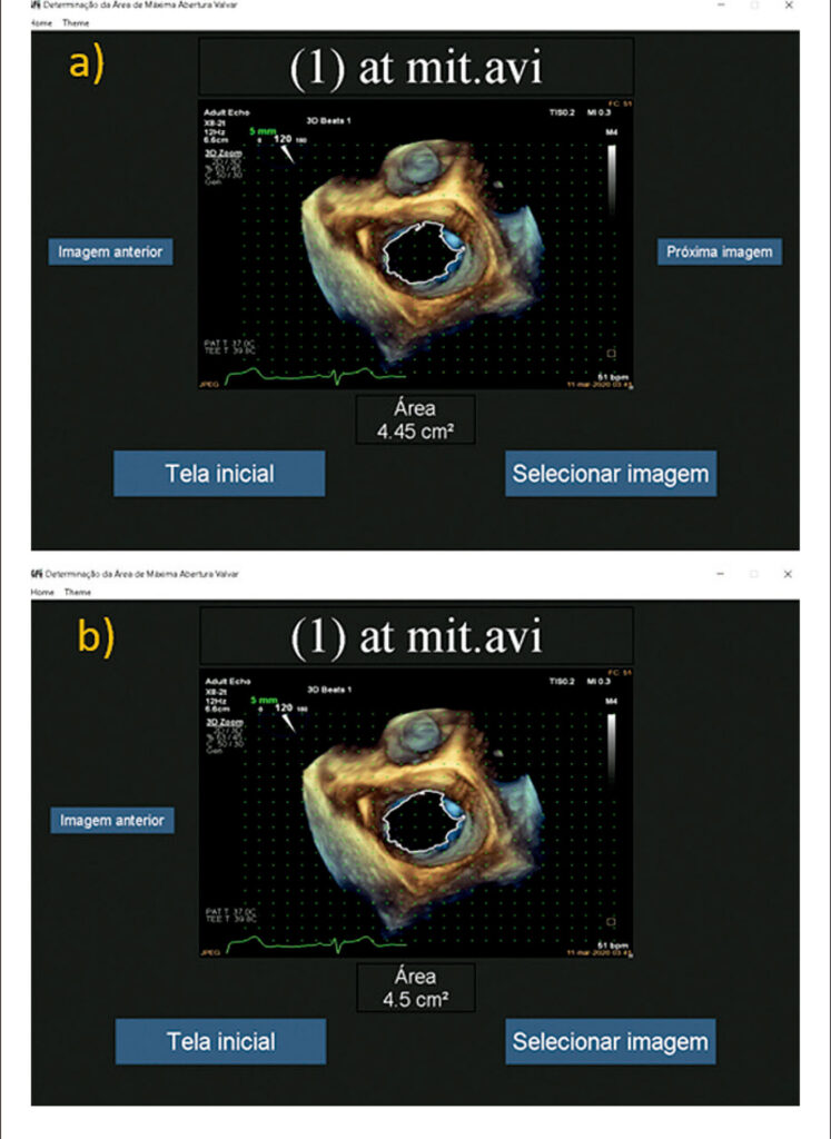 Figura 3