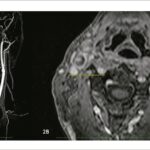 Figura 2