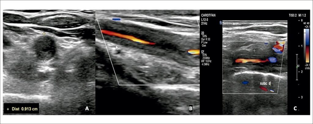 Figura 3