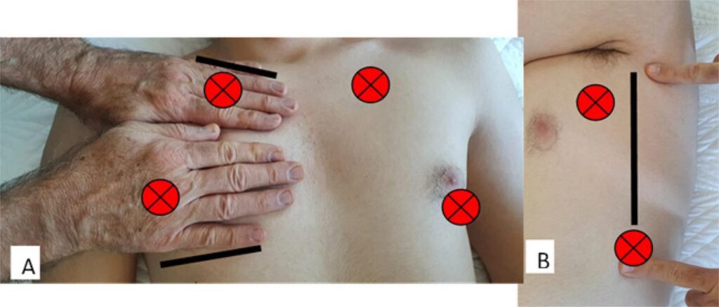 Figura 2
