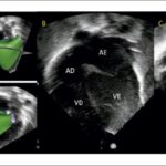 Figura 4