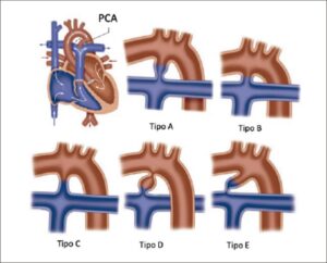 Figura 11