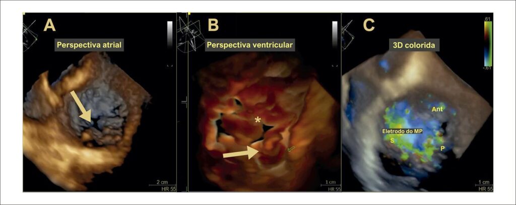 Figura 9