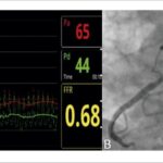 Figura 3