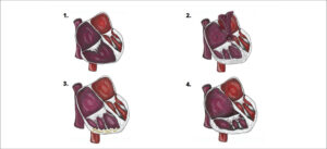 Figura 4