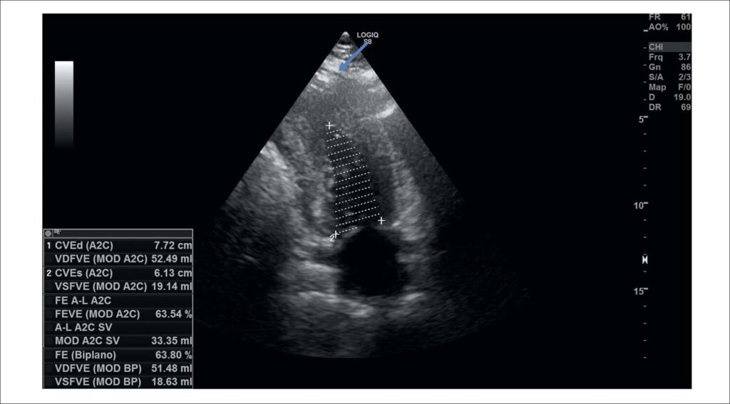 Figura 3