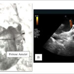 Figura 3