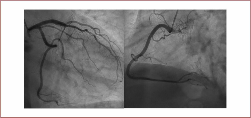 Figure 6 and 7