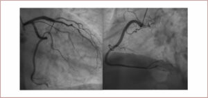 Figure 6 and 7