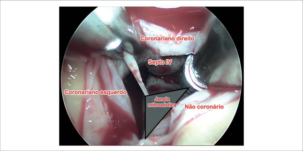Figura 2