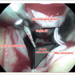 Figura 2
