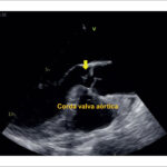 Figura 3