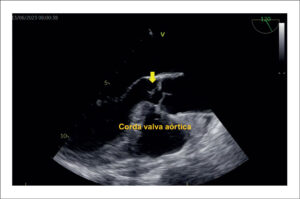 Figura 3