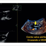Figura 4