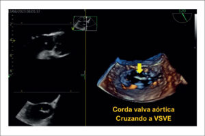 Figura 4