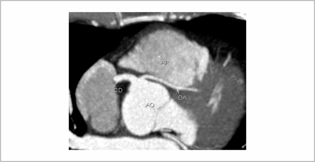 Figure 11