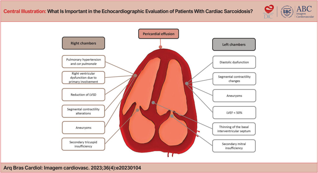 Main echocardiographic findings in sarcoidosis. RV: right ventricle; RV GLS: right ventricle global longitudinal strain; LVEF: left ventricle ejection fraction.