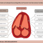 Principais achados ecocardiográficos na sarcoidose. VD: ventrículo direito; SGLVD: strain global longitudinal do ventrículo direito; FEVE: fração de ejeção do ventrículo esquerdo..
