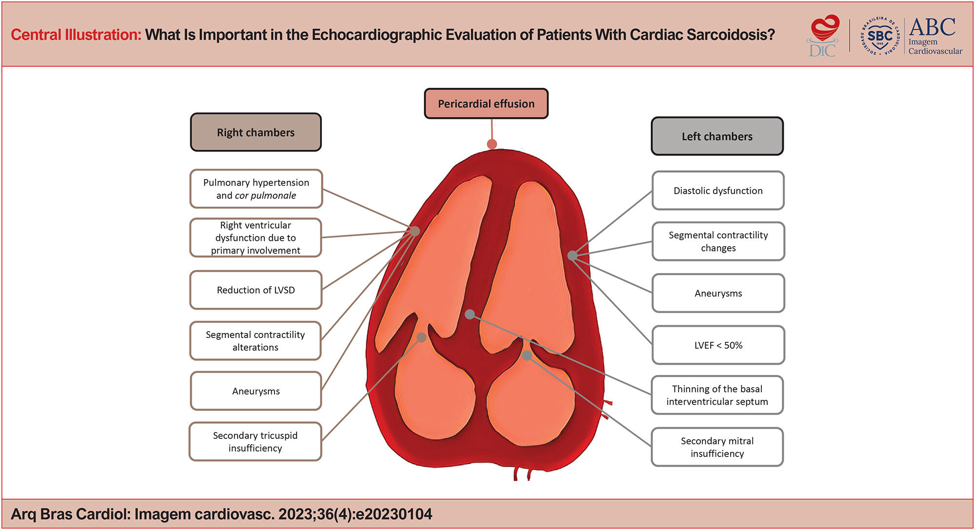 What Is Important in the Echocardiographic Evaluation of Patients With Cardiac Sarcoidosis?