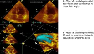 Figura 2