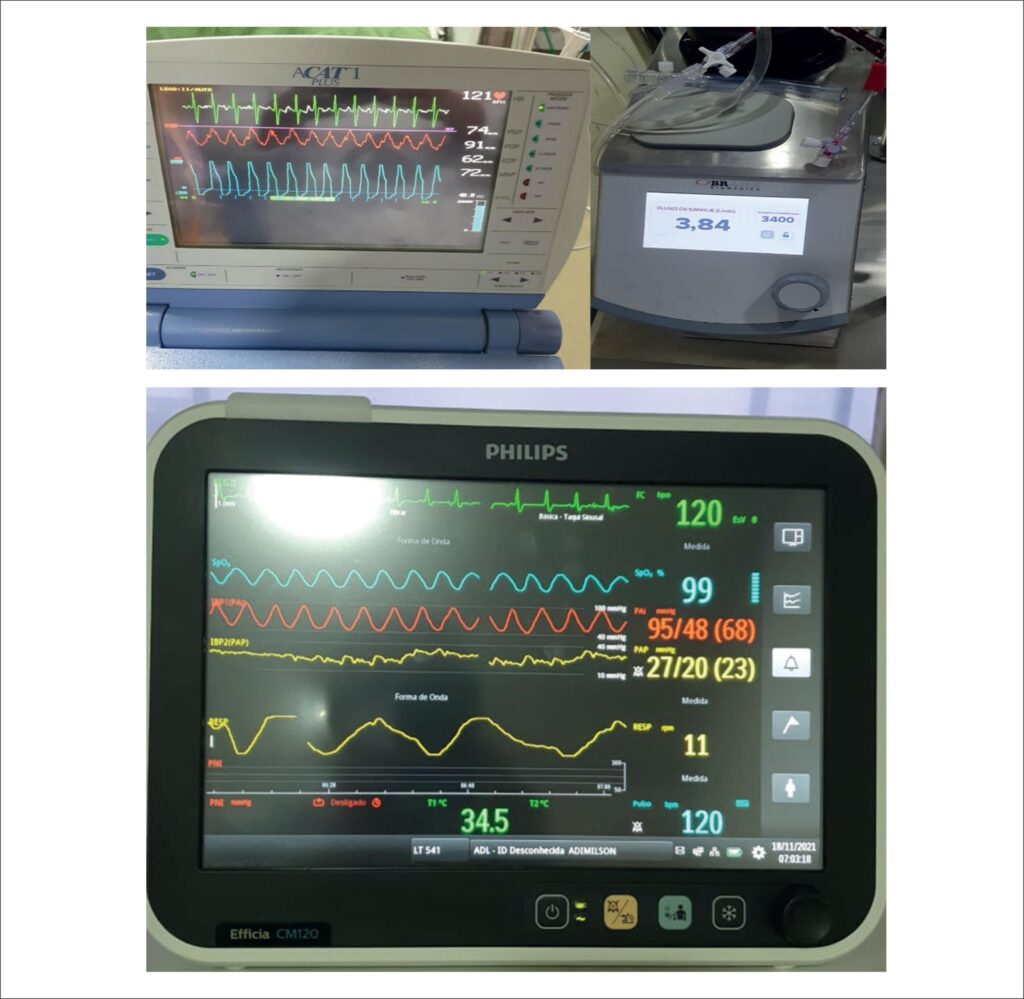 Figure 2